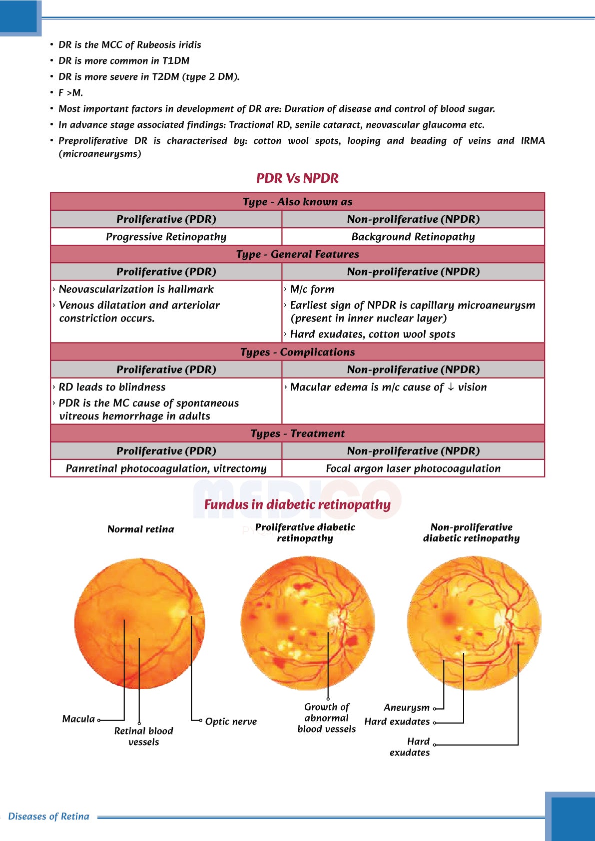 FMGE Modules: Ophthalmology
