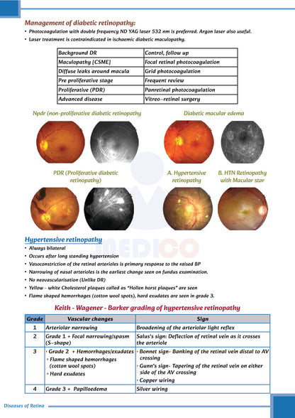 FMGE Modules: Ophthalmology