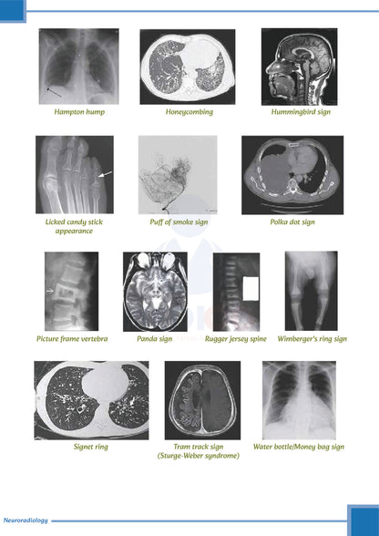 Learn Pro Notes | MedPG & Medico